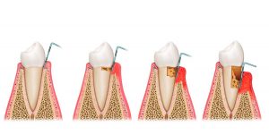 clinica dental sevilla